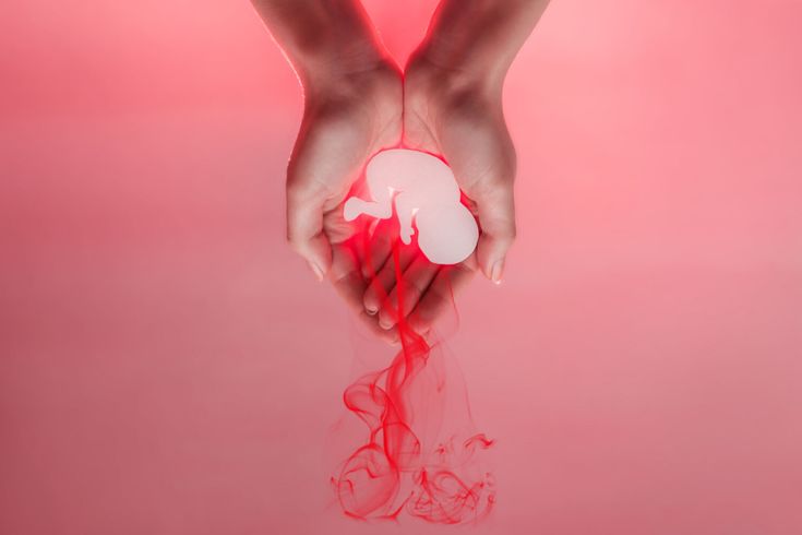 What to Expect During a Medication Abortion