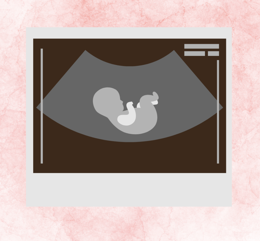 Abortion pills for second pregnancy